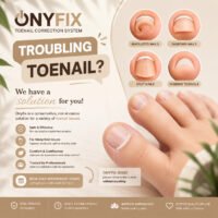 Onyfix Nail Corrections System